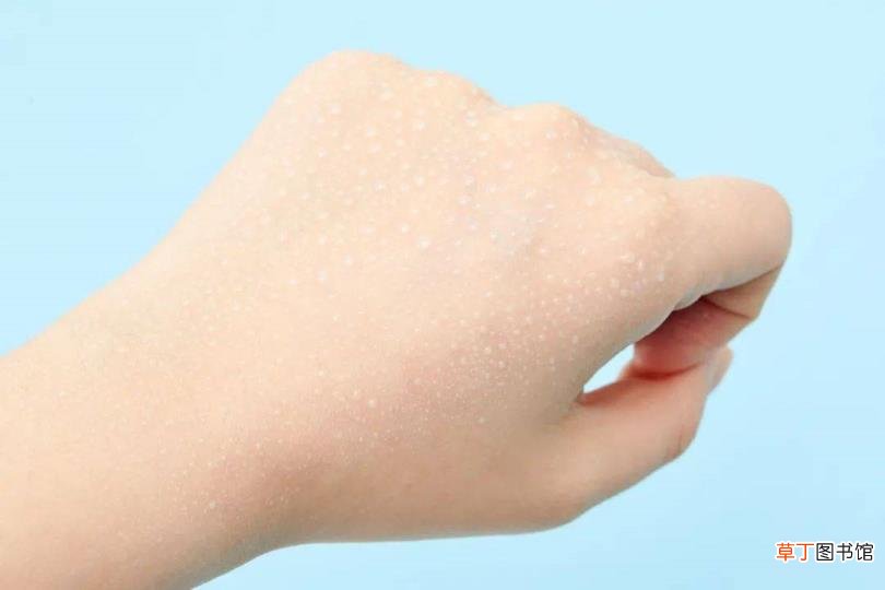 骨折后多久可以泡澡 骨折多久可以洗澡