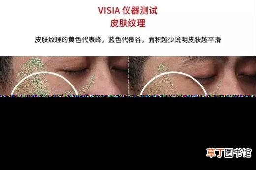 骨癌晚期太疼了怎么办 骨癌晚期能活多久