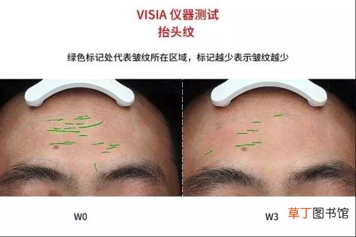 骨癌晚期太疼了怎么办 骨癌晚期能活多久