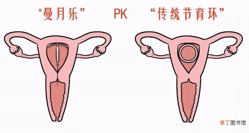 高效孕酮吃多长时间 孕酮要吃多久