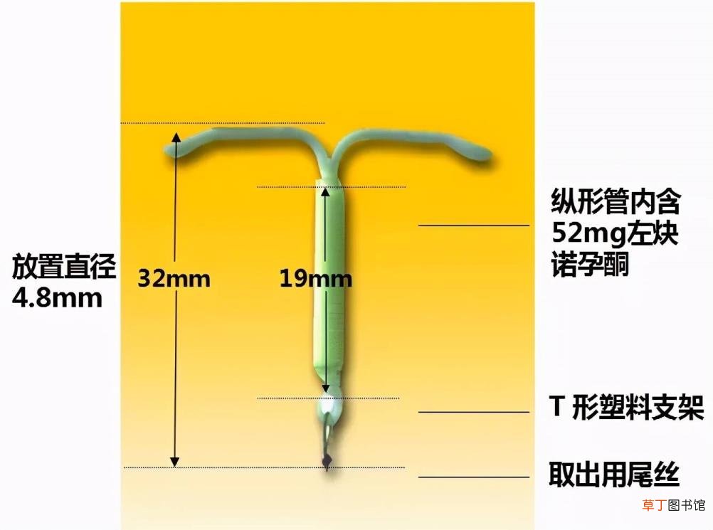 高效孕酮吃多长时间 孕酮要吃多久