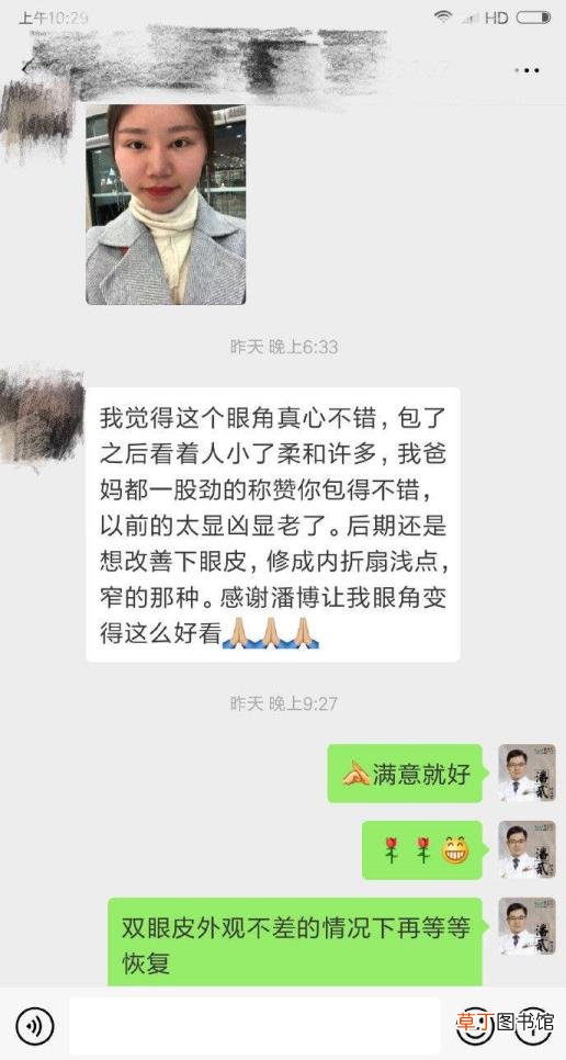 眼角增生是什么样子 开眼角要多久恢复