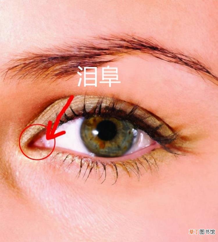 眼角增生是什么样子 开眼角要多久恢复