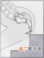 碰到尾骨为啥这么疼 为什么尾骨痛
