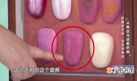 手上长血红色的点是为什么? 手上为什么长斑