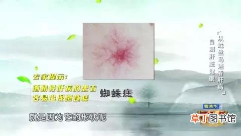 手上长血红色的点是为什么? 手上为什么长斑