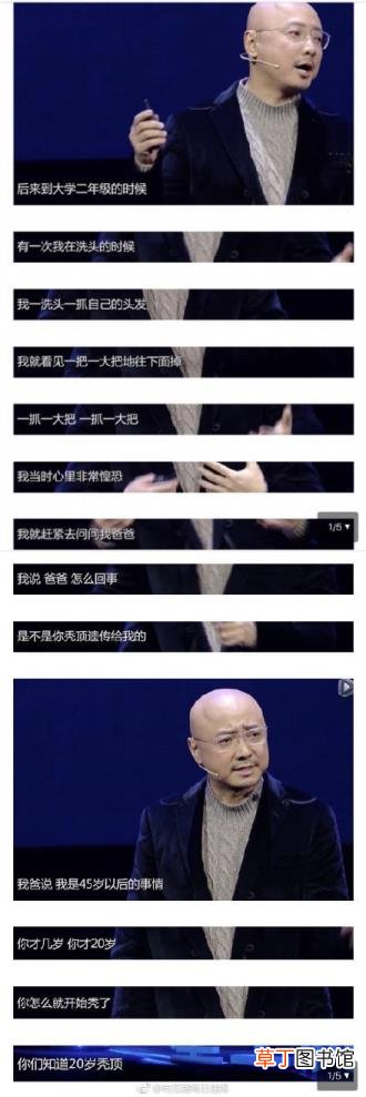 郑恺为什么剃光头 徐峥为什么光头