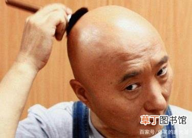 郑恺为什么剃光头 徐峥为什么光头