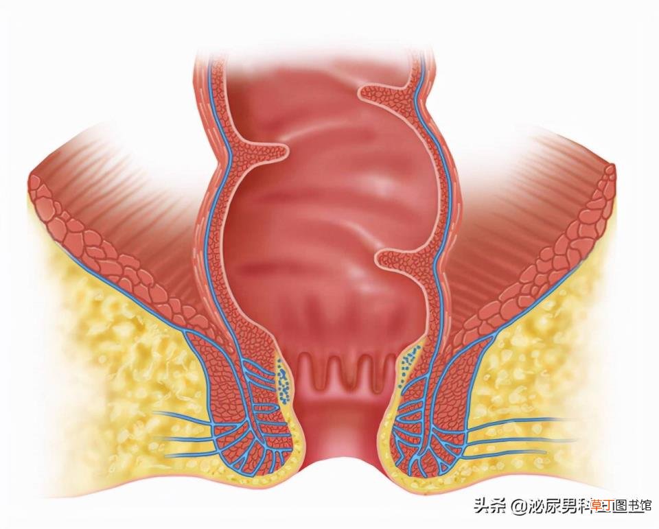 什么原因会导致肛瘘 为什么得肛瘘