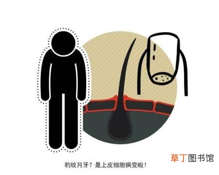 指甲黑了一块 指甲为什么发黑