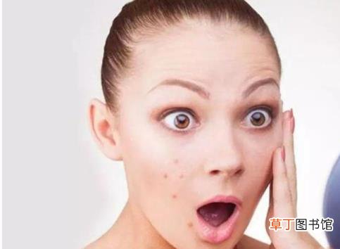 脸上最近一直长痘痘 为什么最近脸上长痘