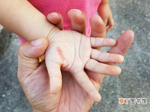 阴虱是什么原因得的 为什么阴毛是直的