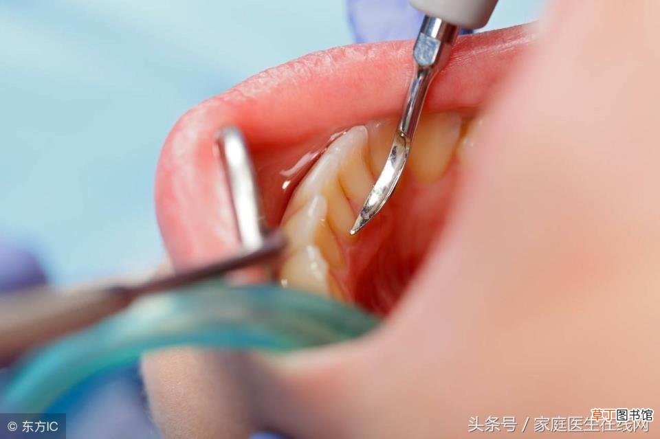 牙齿表面有白色的东西是什么 牙齿为什么是白色的