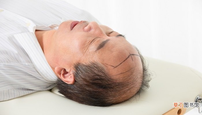 梦见自己秃顶了一大片