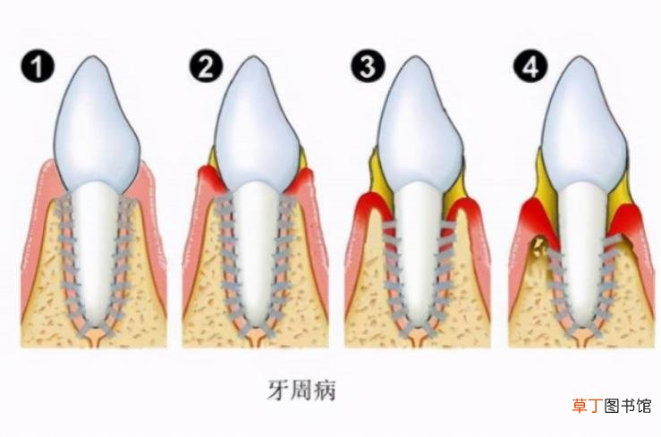 牙齿很臭怎么办 为什么牙血臭