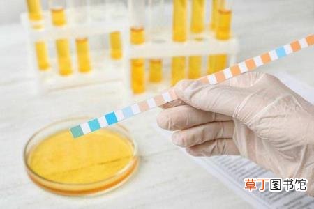 女性正确膀胱位置 膀胱为什么会痛