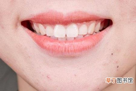 大牙蛀牙已经烂空了用拔吗 牙齿为什么会有洞
