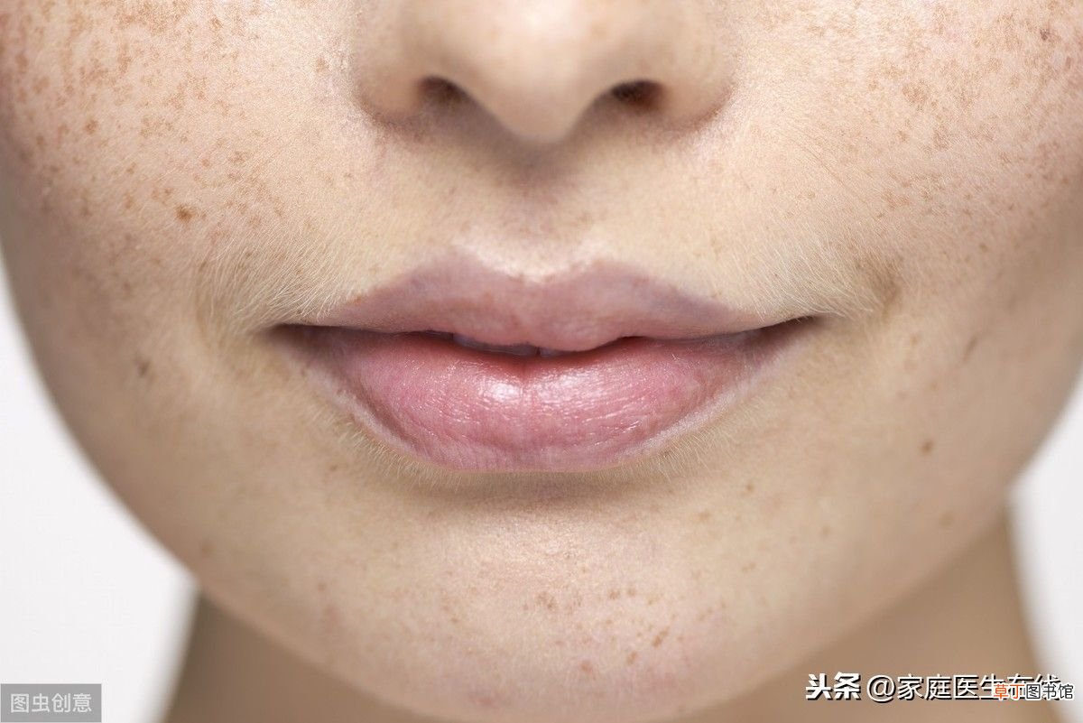 长了黄褐斑，怎样去除比较安全？ 黄褐斑如何去掉呢