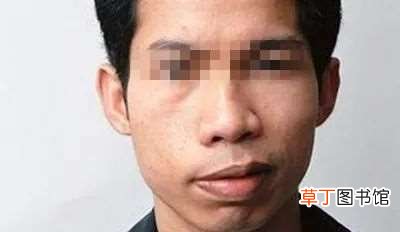 我又好了 我面瘫了