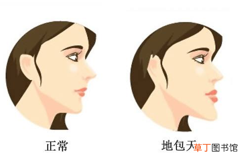 牙齿矫正能改变脸型吗？ 牙齿矫正与脸型