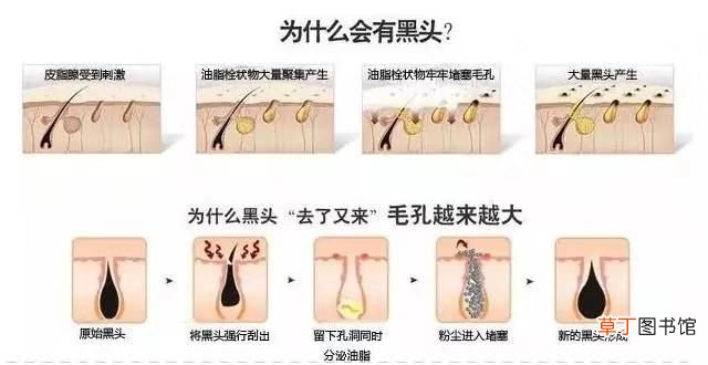 12个快速祛痘小偏方 去痘痘偏方