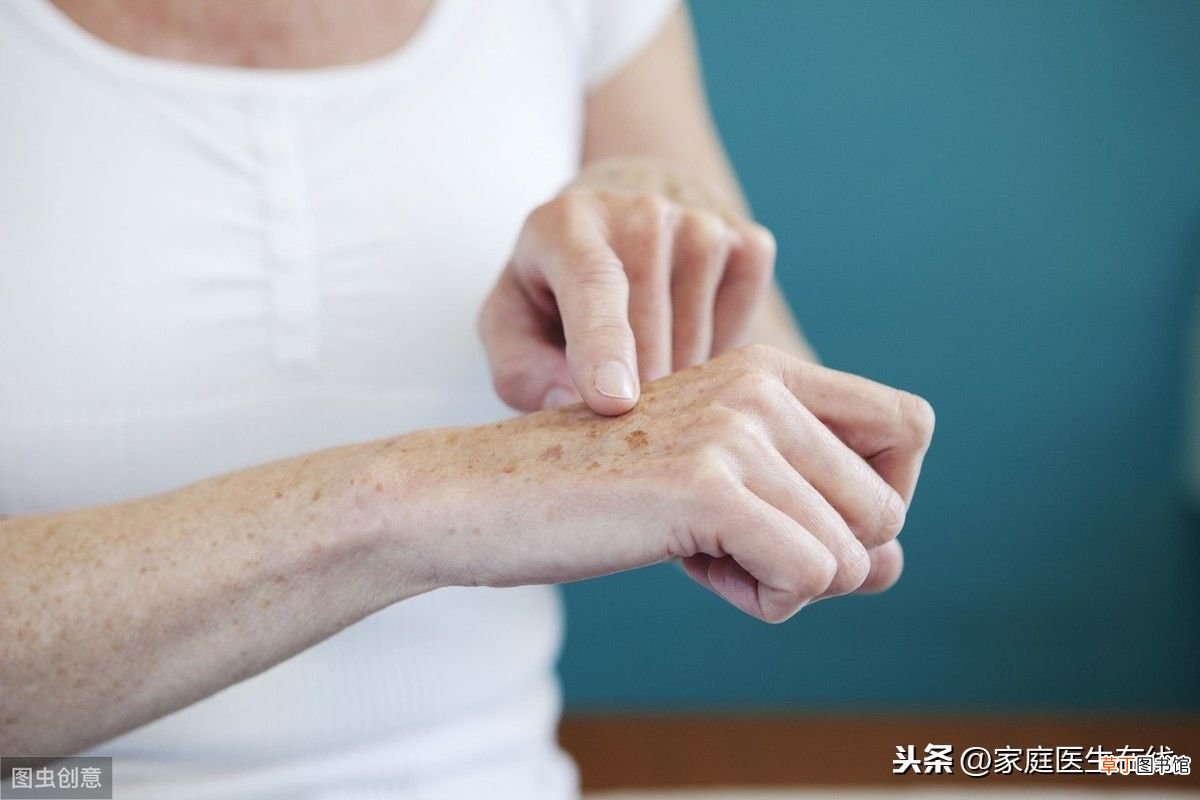 一般几岁开始长老年斑？ 多大年龄长老年斑