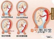 乳房摸着有很大硬块怎么回事 为什么乳房里有硬块