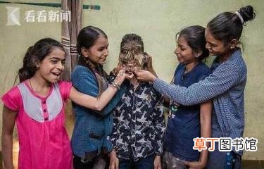 小孩子脸上长毛是怎么回事 为什么脸上长汗毛