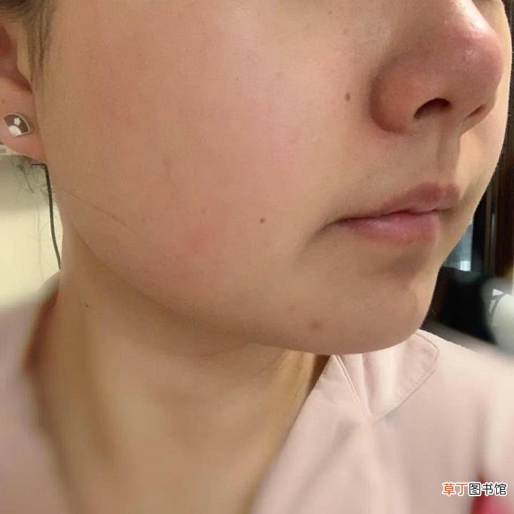 很容易脸红的女孩是什么原因 为什么容易脸红
