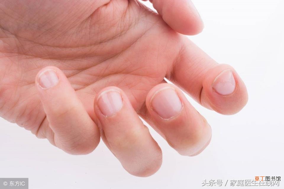 指甲变形凹凸不平是什么原因 为什么指甲不平