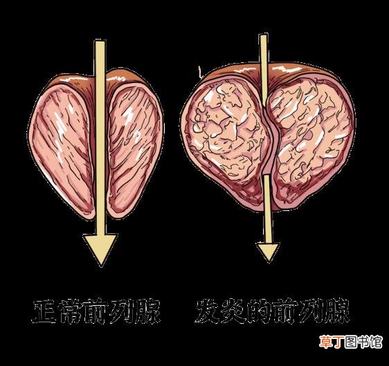 精子为什么会自动流出来 精子为什么是透明的