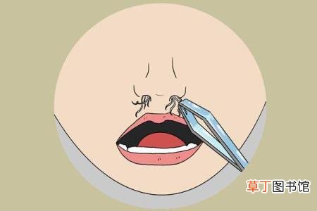 鼻毛比头发又黑又硬 为什么鼻毛又黑又粗