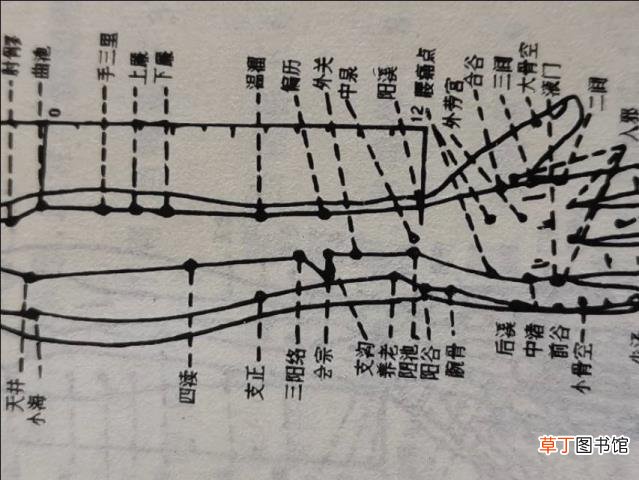 针灸酸胀感越强越好吗 针灸为什么不出血