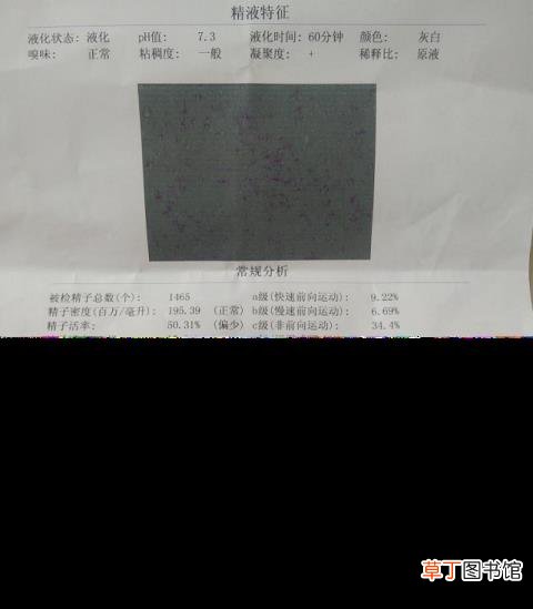 精子是淡红色的是什么原因 精子为什么是红色的