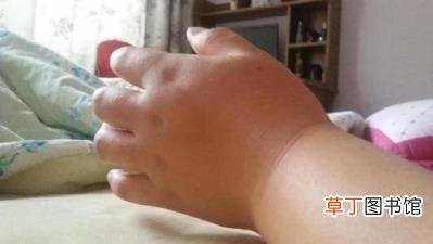 孕妇为什么右手肿左手不肿 怀孕为什么手肿