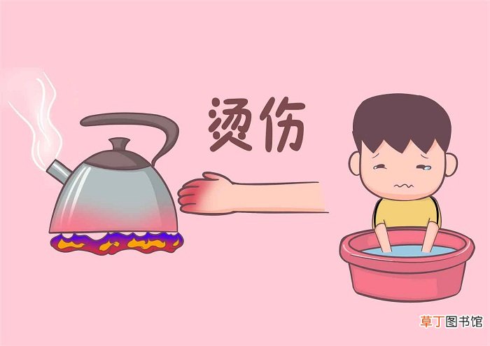 治疗烧烫伤灼伤的5种民间小偏方