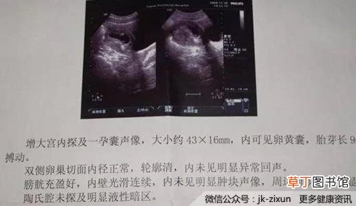 为什么出现大孕囊 为什么孕囊小
