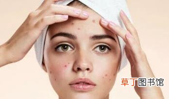 痘痘长在皮肤里成硬块 痘痘为什么会疼