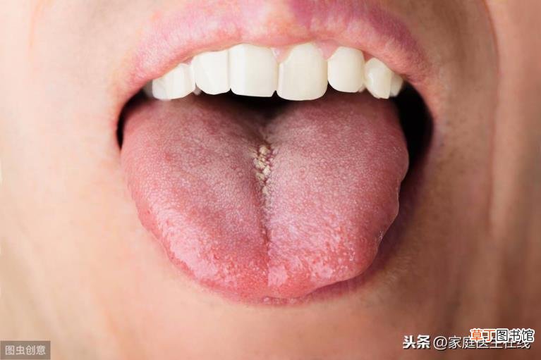 锯齿状舌头 为什么有锯齿