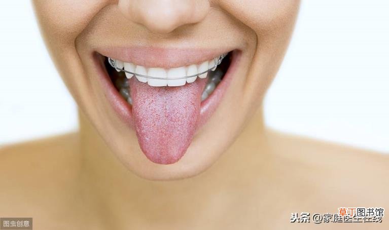 锯齿状舌头 为什么有锯齿