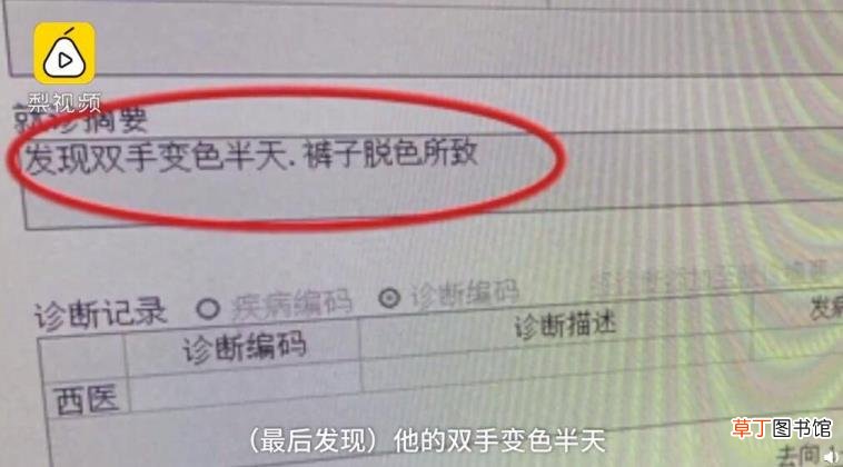 手指纹里面黑黑的洗不掉 手为什么会黑
