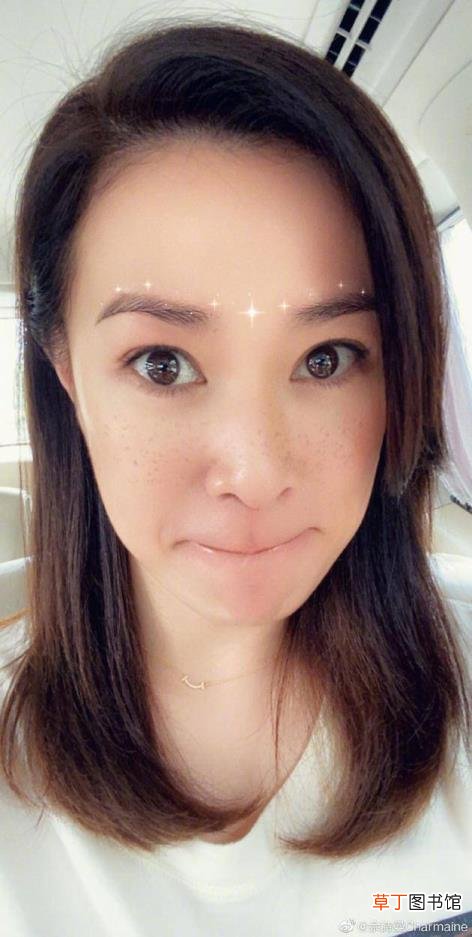 面部七种斑的图片 年轻人为什么长老年斑