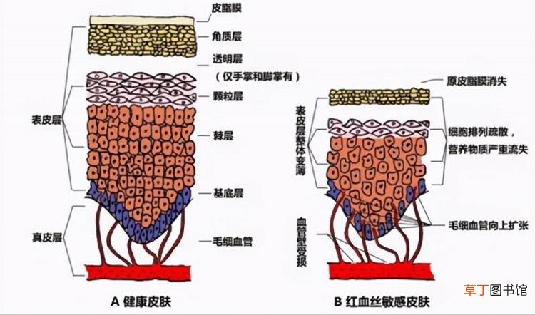 脸上红血丝怎么调理 为什么有红血丝