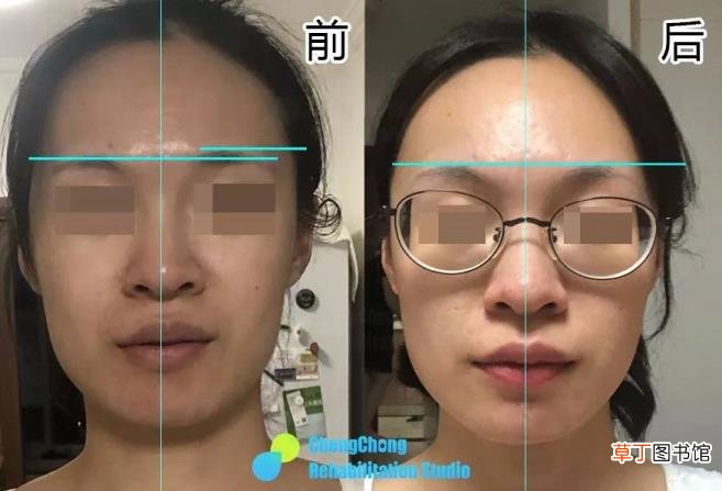 什么会导致脸大 为什么会脸大