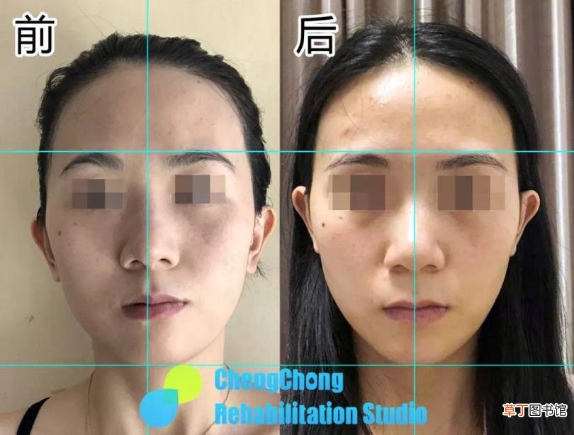 什么会导致脸大 为什么会脸大