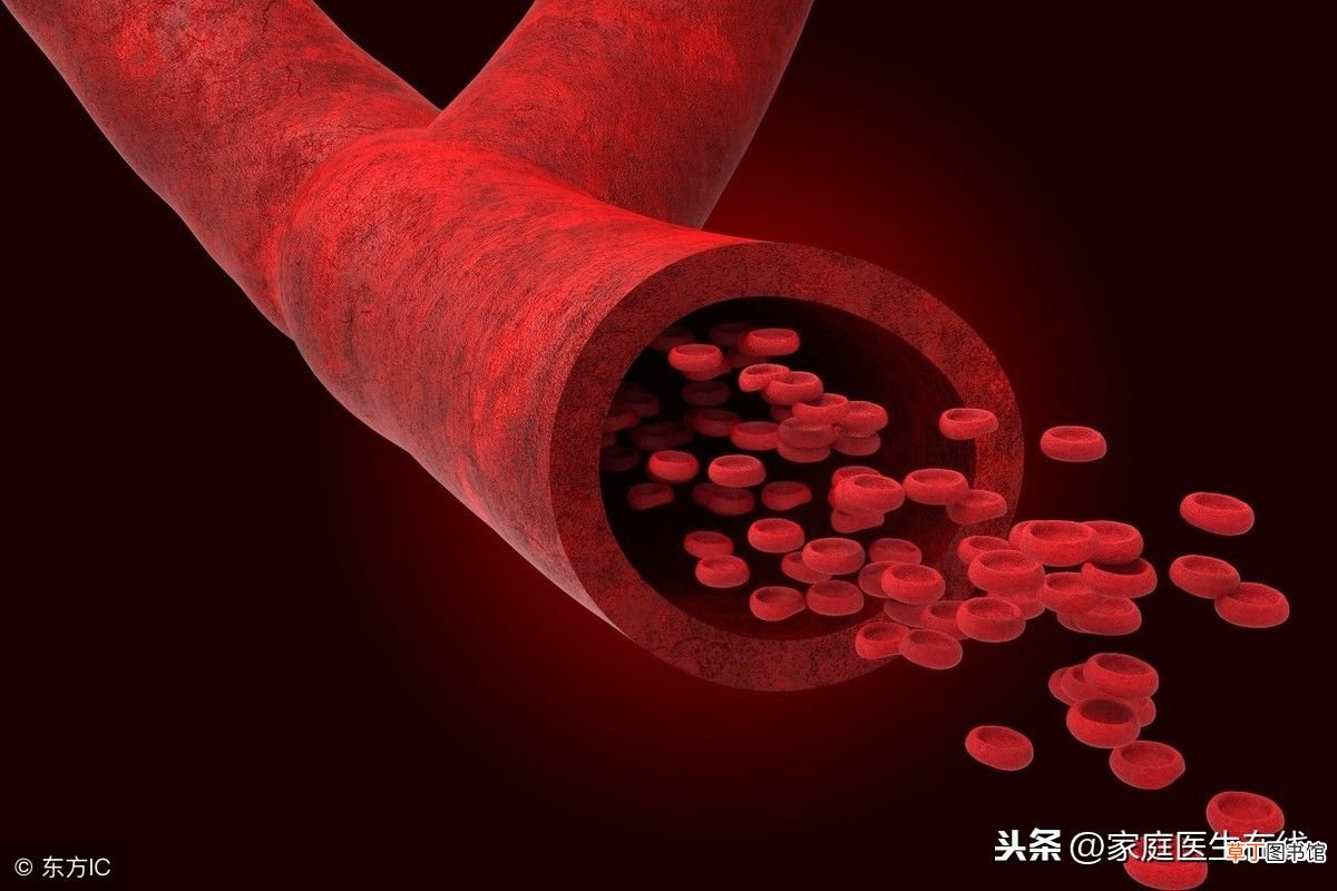 患上动脉硬化怎么办？ 动脉硬化怎么办