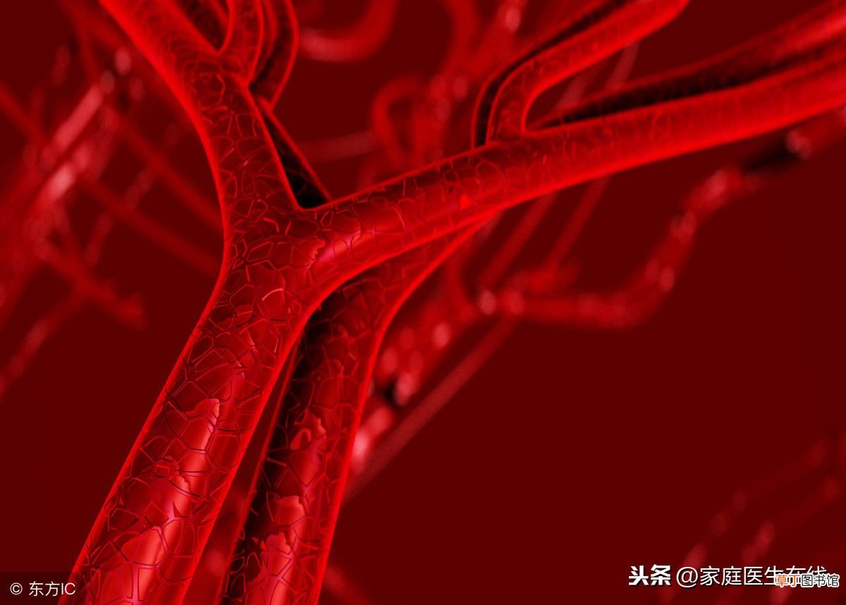 患上动脉硬化怎么办？ 动脉硬化怎么办
