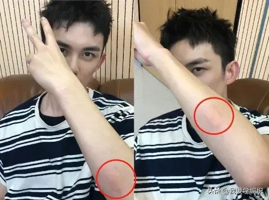 你知道蚊子最怕什么吗？ 蚊子怕什么？