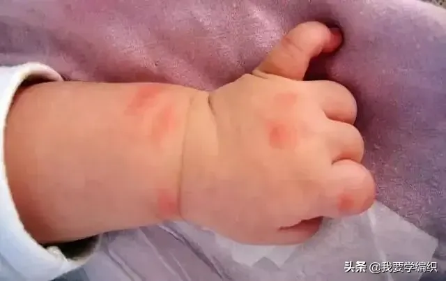 你知道蚊子最怕什么吗？ 蚊子怕什么？