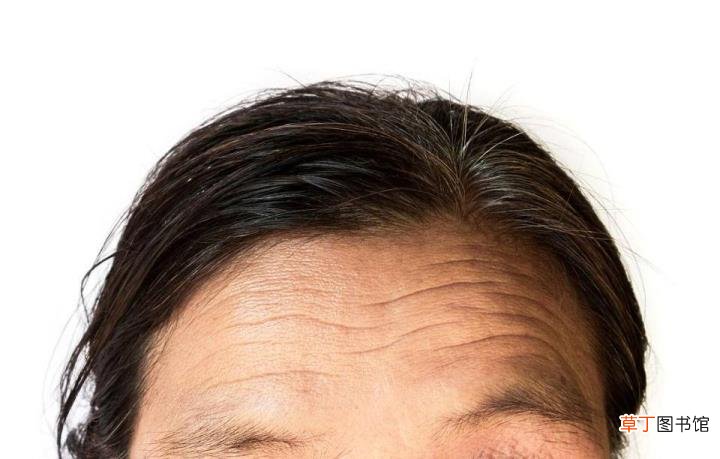 头发细软是什么原因造成的 为什么头发细软